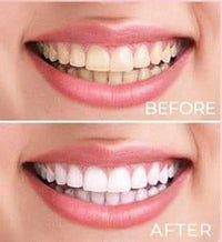 INTERSTELLAR HOT PINK COSMIC SMILE TEETH WHITENING WIRELESS KIT - Happily Ever Atchison Shop Co.